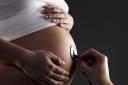 There has been an increase in teenage pregnancies in Cambridgeshire.