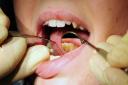 NHS Devon has said it is working with local dentists to improve access