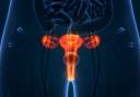 Around 2,700 women are diagnosed with cervical cancer in England each year and around 850 women die.