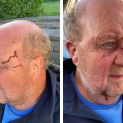 Patrick Atherton was attacked by cows while walking on a public footpath in Devon.